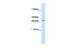 TFB2M Antibody in Western Blot (WB)