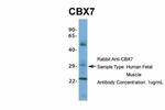 CBX7 Antibody in Western Blot (WB)