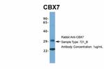 CBX7 Antibody in Western Blot (WB)