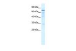 TRMT1 Antibody in Western Blot (WB)