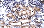 BERP Antibody in Immunohistochemistry (IHC)