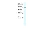 BERP Antibody in Western Blot (WB)