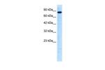 UHRF2 Antibody in Western Blot (WB)