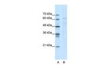 CACNB3 Antibody in Western Blot (WB)