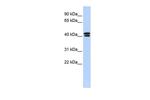 CACNB3 Antibody in Western Blot (WB)