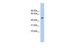 CHRNA5 Antibody in Western Blot (WB)