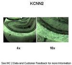 KCNN2 Antibody in Immunohistochemistry (IHC)