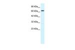 KCNN2 Antibody in Western Blot (WB)