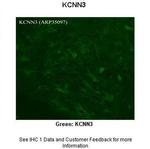 KCNN3 Antibody in Immunohistochemistry (Paraffin) (IHC (P))