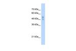 P2X1 Antibody in Western Blot (WB)