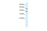 HTR3B Antibody in Western Blot (WB)