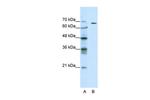 GABRQ Antibody in Western Blot (WB)