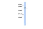 GABRB3 Antibody in Western Blot (WB)