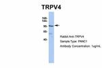 TRPV4 Antibody in Western Blot (WB)