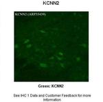 KCNN2 Antibody in Immunohistochemistry (IHC)