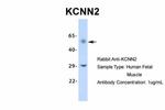 KCNN2 Antibody in Western Blot (WB)