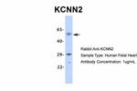 KCNN2 Antibody in Western Blot (WB)