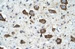 KChIP2 Antibody in Immunohistochemistry (IHC)