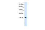 KChIP2 Antibody in Western Blot (WB)