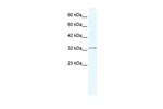 NUDT9 Antibody in Western Blot (WB)