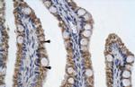 PITX2 Antibody in Immunohistochemistry (IHC)