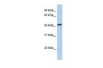 FOXJ1 Antibody in Western Blot (WB)