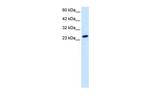 TBPL1 Antibody in Western Blot (WB)