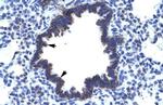 CHST4 Antibody in Immunohistochemistry (IHC)