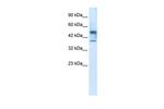 CHST4 Antibody in Western Blot (WB)