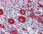 VEZF1 Antibody in Immunohistochemistry (Paraffin) (IHC (P))