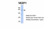 VEZF1 Antibody in Western Blot (WB)