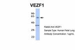 VEZF1 Antibody in Western Blot (WB)