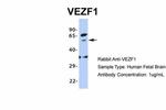 VEZF1 Antibody in Western Blot (WB)