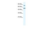 ZNF223 Antibody in Western Blot (WB)