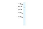 ZNF224 Antibody in Western Blot (WB)