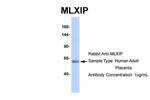 MLXIP Antibody in Western Blot (WB)