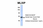 MLXIP Antibody in Western Blot (WB)