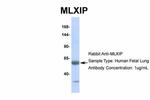 MLXIP Antibody in Western Blot (WB)