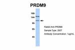 PRDM9 Antibody in Western Blot (WB)