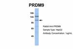 PRDM9 Antibody in Western Blot (WB)