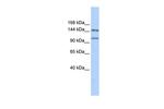 PRDM9 Antibody in Western Blot (WB)