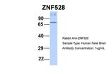 ZNF528 Antibody in Western Blot (WB)