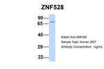 ZNF528 Antibody in Western Blot (WB)