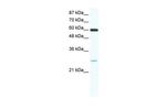 ZFP91 Antibody in Western Blot (WB)