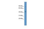 ZNF540 Antibody in Western Blot (WB)