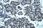 PTEN2 Antibody in Immunohistochemistry (IHC)