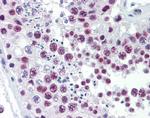 SOX4 Antibody in Immunohistochemistry (IHC)