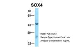 SOX4 Antibody in Western Blot (WB)