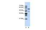 BLZF1 Antibody in Western Blot (WB)