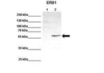 ETV1 Antibody in Western Blot (WB)